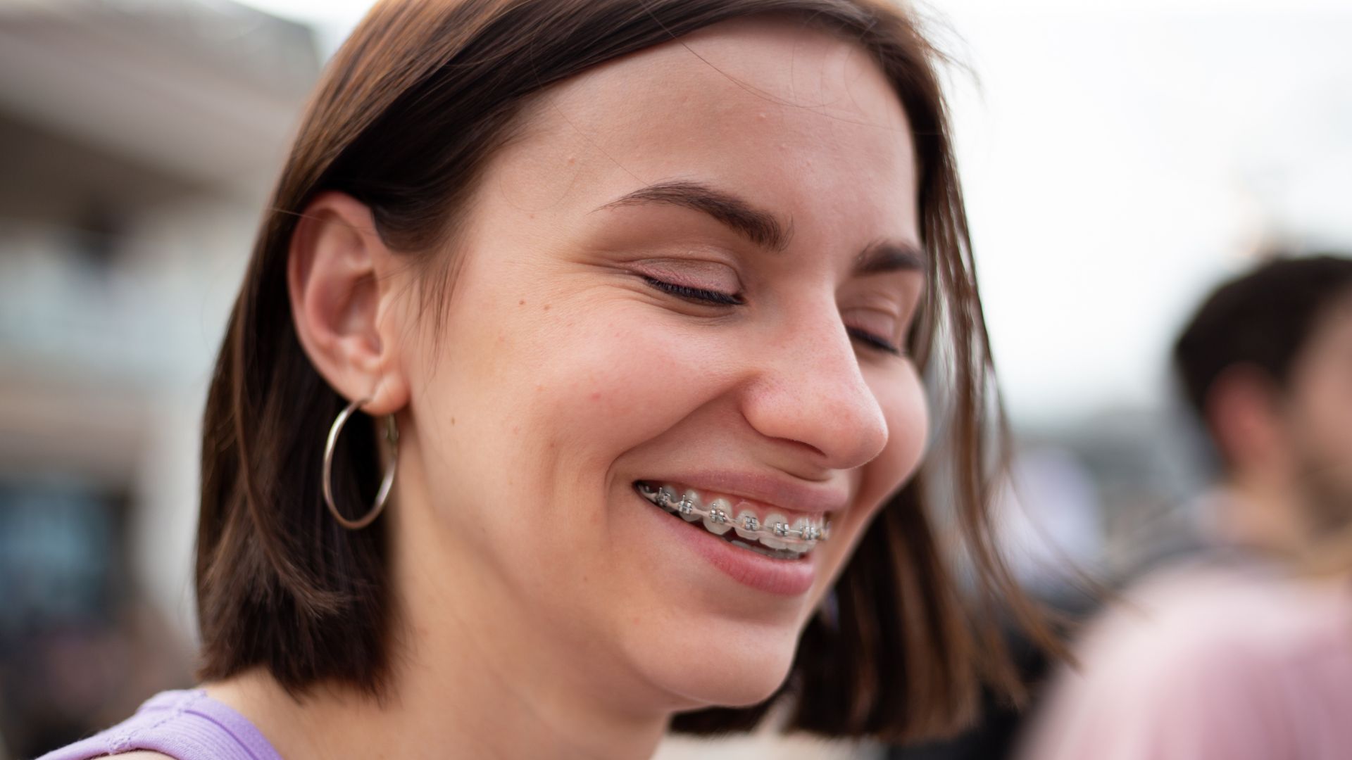 Invisible Braces Cost near  Ahmedabad