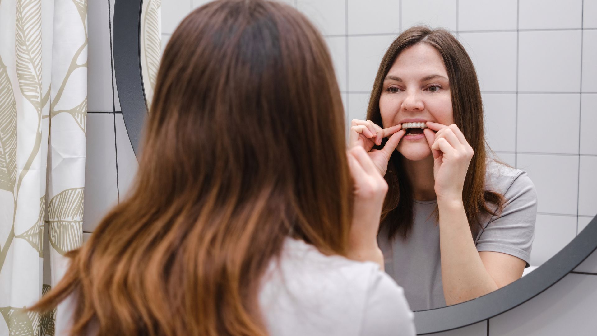Affordable Clear Aligners Cost near  Ahmedabad